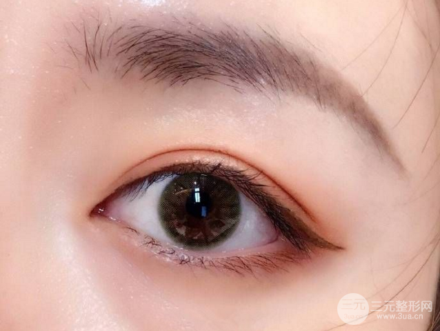 全切双眼皮价格