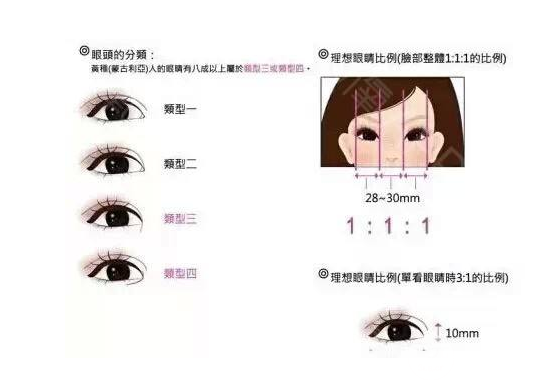 割双眼皮开眼角