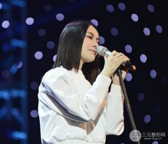 尚雯婕 整容