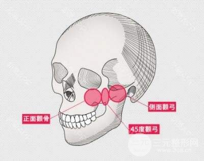 磨骨手术死亡率大吗