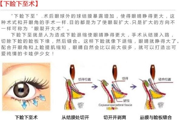 眼睑下至恢复过程图