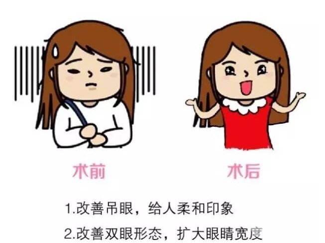 眼睑下至优缺点