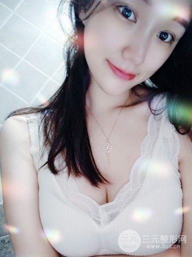 娜绮丽假体隆胸手术日记