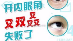 开眼角后真心变丑了！来看看开眼角失败的几大症状！