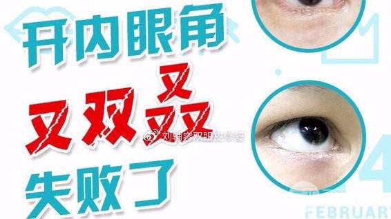 开眼角后真心变丑了