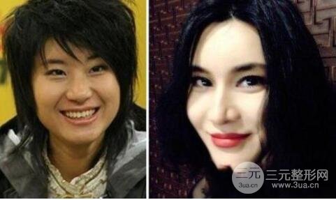 尚雯婕前后对比照来啦，不得不说明星变美的功力很好！