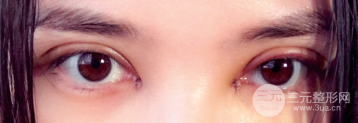 开眼角和不开的区别图