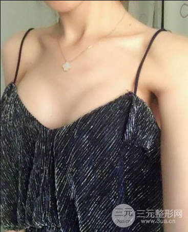 娜绮丽价格