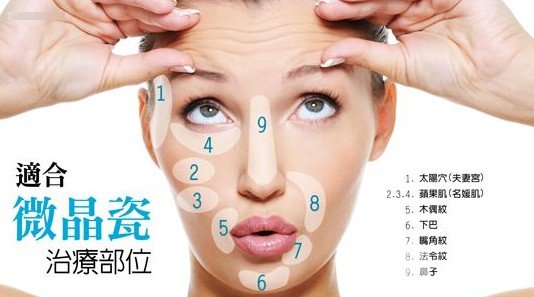 Radiesse隆鼻为啥只在台湾火