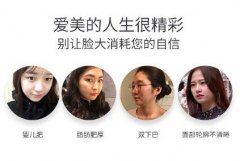 面部吸脂瘦脸手术做完10天图片，外观能看出来变化吗?
