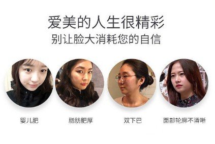 面部吸脂瘦脸手术
