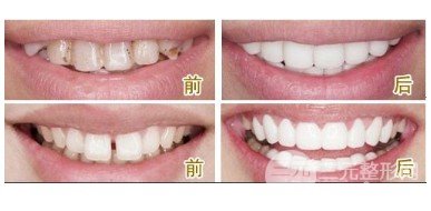 北海牙博士口腔价目表