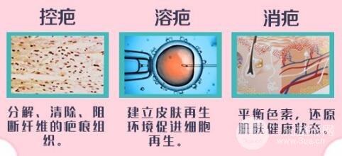 上海翡立思医疗陈立彬疤痕修复技术