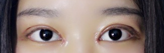 开眼角和不开眼角图片