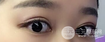 开眼角和不开眼角图片
