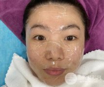 彩光嫩肤美白成好吗？20天恢复照片对比