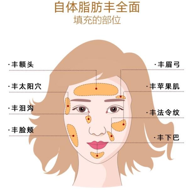 脂肪填充的相关注意事项