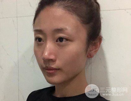 白瓷娃娃祛斑果怎么样