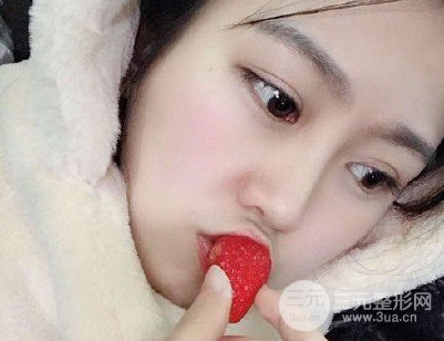注射胶原蛋白隆鼻多少钱