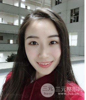 面部精细吸脂经历