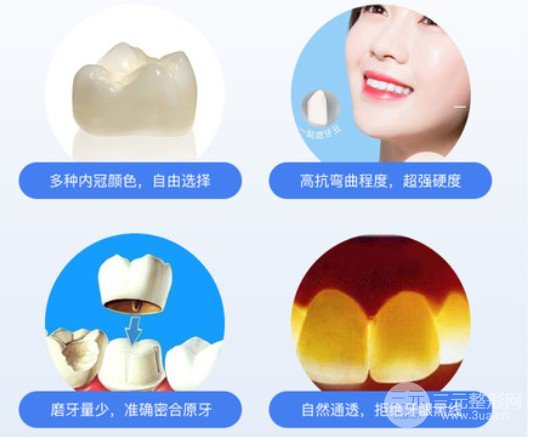 全瓷烤瓷牙价格