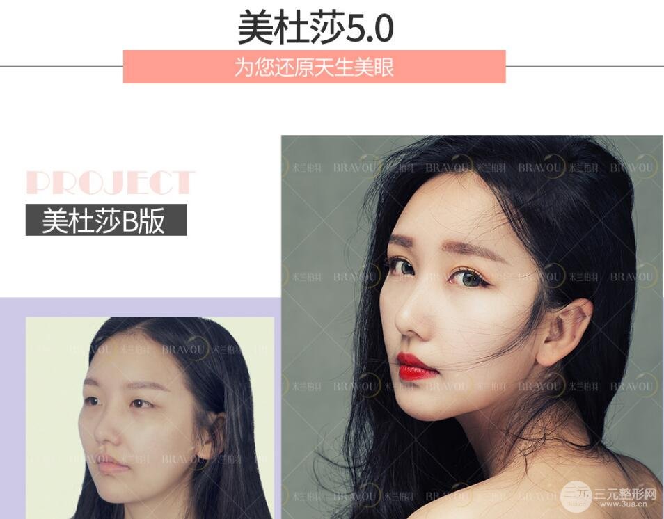 美杜莎双眼皮
