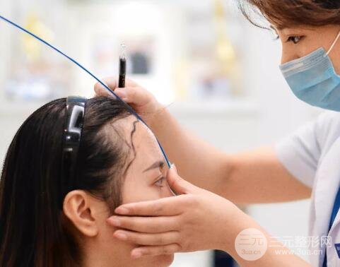 发际线整形是否有后遗症出现?