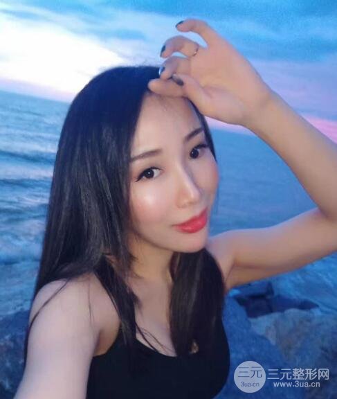 植发案例