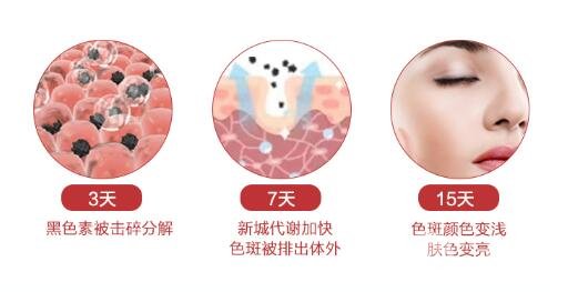 点阵激光手术原理