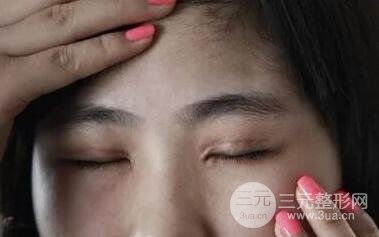 开眼角的注意事项