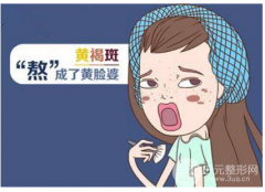 激光祛黄褐斑果如何？祛斑价格贵吗？
