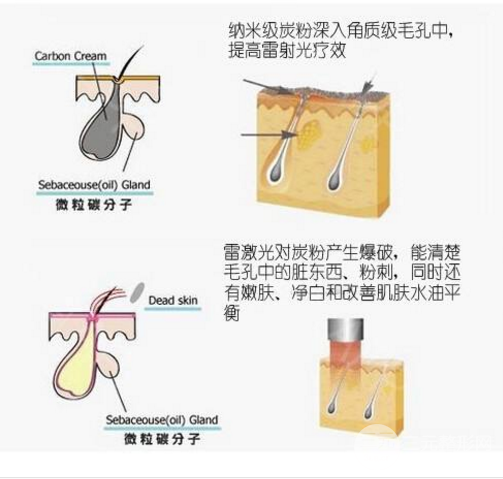 黑脸娃娃的功