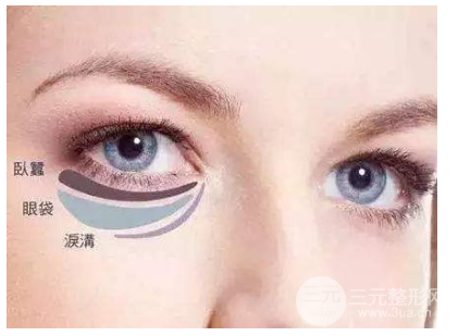 眼袋和黑眼圈的区别