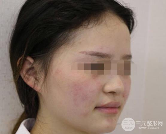 北京卓新华星医疗美容门诊部概况&专家名单表&祛斑手术反馈~
