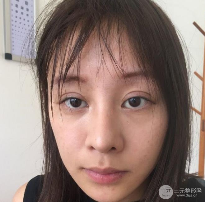 北京卓新华星医疗美容门诊部概况&专家名单表&祛斑手术反馈~