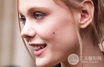 去痣多少钱一颗