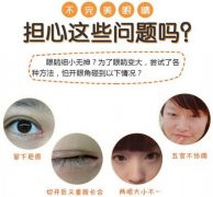 开眼角为什么显老？别等做了后悔，先来看看科普！