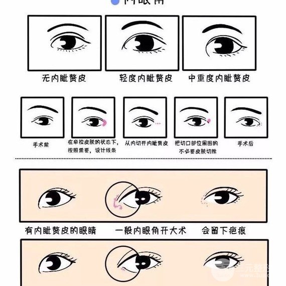开眼角为什么显老