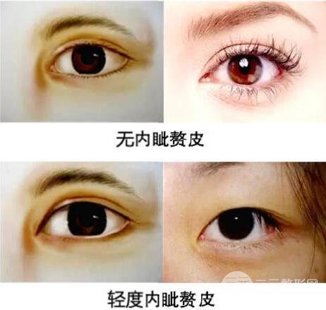 不适合开眼角眼型图片