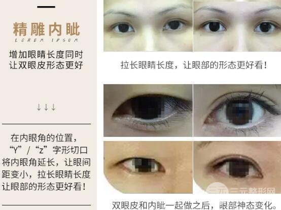 适合开眼角的眼睛图解