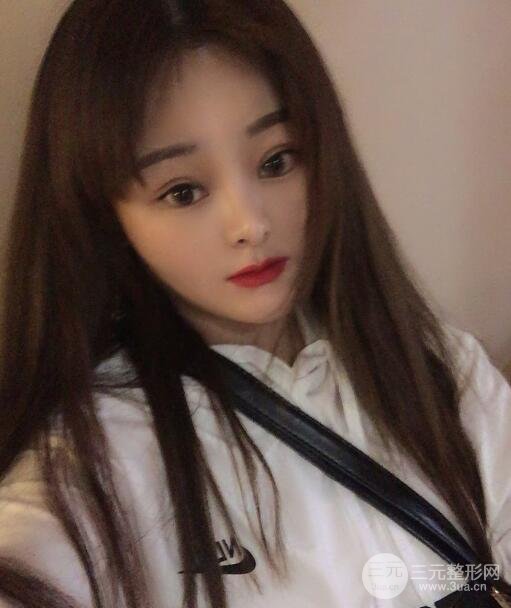 做完拉皮手术8天