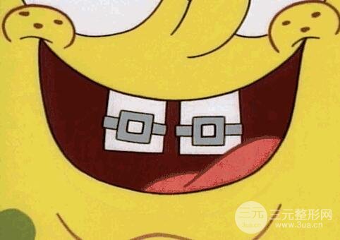 烤瓷牙多少钱一颗？一颗能用多少年？烤瓷牙案例