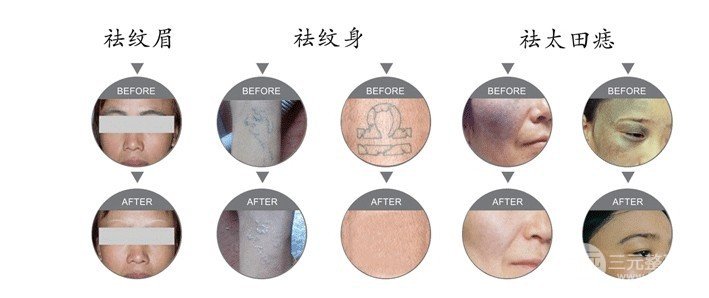 黑脸娃娃嫩肤疼吗