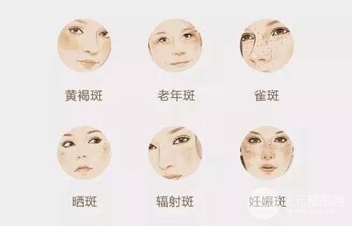 黑脸娃娃嫩肤疼吗