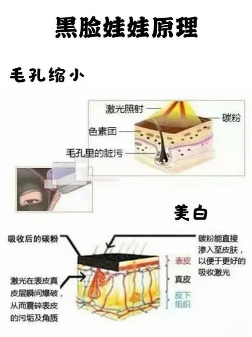 黑脸娃娃嫩肤疼吗