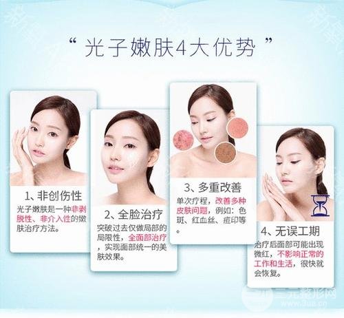 光子嫩肤美白成好吗