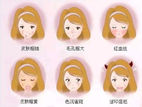 光子嫩肤美白成好吗