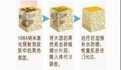 解决皮肤干粗糙问题，这几种医美方法很靠谱！