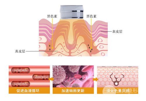 解决皮肤干粗糙问题,这几种医美方法很靠谱