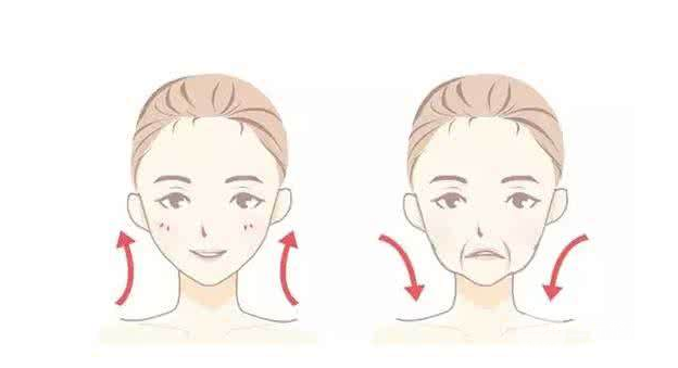 玻尿酸鼻唇沟除皱
